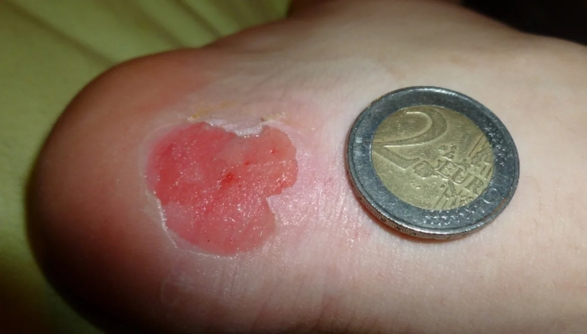 Die Wettervorhersage war auch in diesem Jahr nicht eindeutig. Aber wir weil die JDAV schon im letzten Jahr gute Erfahrung gemacht hatte, sagte man sich auch für den diesjährigen Ostermix, dass Regen zu Hause in jedem Fall schlechter ist als Schneefall in den Bergen. Die erste 5-köpfige Gruppe startete am 28.03.2013 Richtung Saalfelden/Leogang. Für Gründonnerstag waren noch sehr gute Wetterverhältnisse vorhergesagt. Und das war auch so, denn die Boarder fanden bei herrlichem Wetter beste Pistenbedinungen vor und die Skitourengehern konnten das erstemal ein dieser Saison eine herrliche Firnabfahrt vom Seehorn geniesen. Den nächsten Tag verbrachte die JDAV Jugend nochmal im Skigebiet Leogang, wobei am Freitagabend, nach einem intensiven Klettertag an der Weissbachwand, die zweite Abordnung der JDAV Ausfahrtsgruppe dazu kam und die Gruppe nun mit neun Teilnehmern vollzählig war. Für den Karsamstag plante die JDAV Gruppe die ganz große Saalbach-Hinterglemm-Runde. Schon kurz vor 9 Uhr stand man an der ersten Gondel um dieses Projekt zu meistern. Mit insgesamt 21 Liftfahrten, 8000 hm Abfahrt und 48 km Wegstrecke war dieser Ski/Boardtag für alle ein tolles Erlebnis und auch eine tolle Leistung. Am einzigen richtigen Schlechtwettertag, dem Ostersonntag, waren die Teilnehmer nicht verlegen. Schnell wurden Ski und Board gegen die Kletterschuhe getauscht und man besuchte die neu erbaute Kletterhalle in Saalfelden. Lange Kletterrouten bis zum 9.ten Schwierigkeitsgrad erfreuten und fordeten die JDAV Klettercracks aus Dingolfing und jeder kletterte was möglich war, frei nach dem Motto: no limits! Der Ostermontag bescherte den Teilnehmer wieder blauen Himmel, Sonnenschein und wegen dem Schneefall vom Vortag nochmal traumhafte Abfahrtsverhältnisse. JDAV - Fazit Ostern 2013: Wieder ein MIX der besonderen Art mit Klettern-Skitouren-Alpinski/Board und kulinarischem Erlebnissen auf der Alm! -> Gefällt uns | © Die Wettervorhersage war auch in diesem Jahr nicht eindeutig. Aber wir weil die JDAV schon im letzten Jahr gute Erfahrung gemacht hatte, sagte man sich auch für den diesjährigen Ostermix, dass Regen zu Hause in jedem Fall schlechter ist als Schneefall in den Bergen. Die erste 5-köpfige Gruppe startete am 28.03.2013 Richtung Saalfelden/Leogang. Für Gründonnerstag waren noch sehr gute Wetterverhältnisse vorhergesagt. Und das war auch so, denn die Boarder fanden bei herrlichem Wetter beste Pistenbedinungen vor und die Skitourengehern konnten das erstemal ein dieser Saison eine herrliche Firnabfahrt vom Seehorn geniesen. Den nächsten Tag verbrachte die JDAV Jugend nochmal im Skigebiet Leogang, wobei am Freitagabend, nach einem intensiven Klettertag an der Weissbachwand, die zweite Abordnung der JDAV Ausfahrtsgruppe dazu kam und die Gruppe nun mit neun Teilnehmern vollzählig war. Für den Karsamstag plante die JDAV Gruppe die ganz große Saalbach-Hinterglemm-Runde. Schon kurz vor 9 Uhr stand man an der ersten Gondel um dieses Projekt zu meistern. Mit insgesamt 21 Liftfahrten, 8000 hm Abfahrt und 48 km Wegstrecke war dieser Ski/Boardtag für alle ein tolles Erlebnis und auch eine tolle Leistung. Am einzigen richtigen Schlechtwettertag, dem Ostersonntag, waren die Teilnehmer nicht verlegen. Schnell wurden Ski und Board gegen die Kletterschuhe getauscht und man besuchte die neu erbaute Kletterhalle in Saalfelden. Lange Kletterrouten bis zum 9.ten Schwierigkeitsgrad erfreuten und fordeten die JDAV Klettercracks aus Dingolfing und jeder kletterte was möglich war, frei nach dem Motto: no limits! Der Ostermontag bescherte den Teilnehmer wieder blauen Himmel, Sonnenschein und wegen dem Schneefall vom Vortag nochmal traumhafte Abfahrtsverhältnisse. JDAV - Fazit Ostern 2013: Wieder ein MIX der besonderen Art mit Klettern-Skitouren-Alpinski/Board und kulinarischem Erlebnissen auf der Alm! -> Gefällt uns